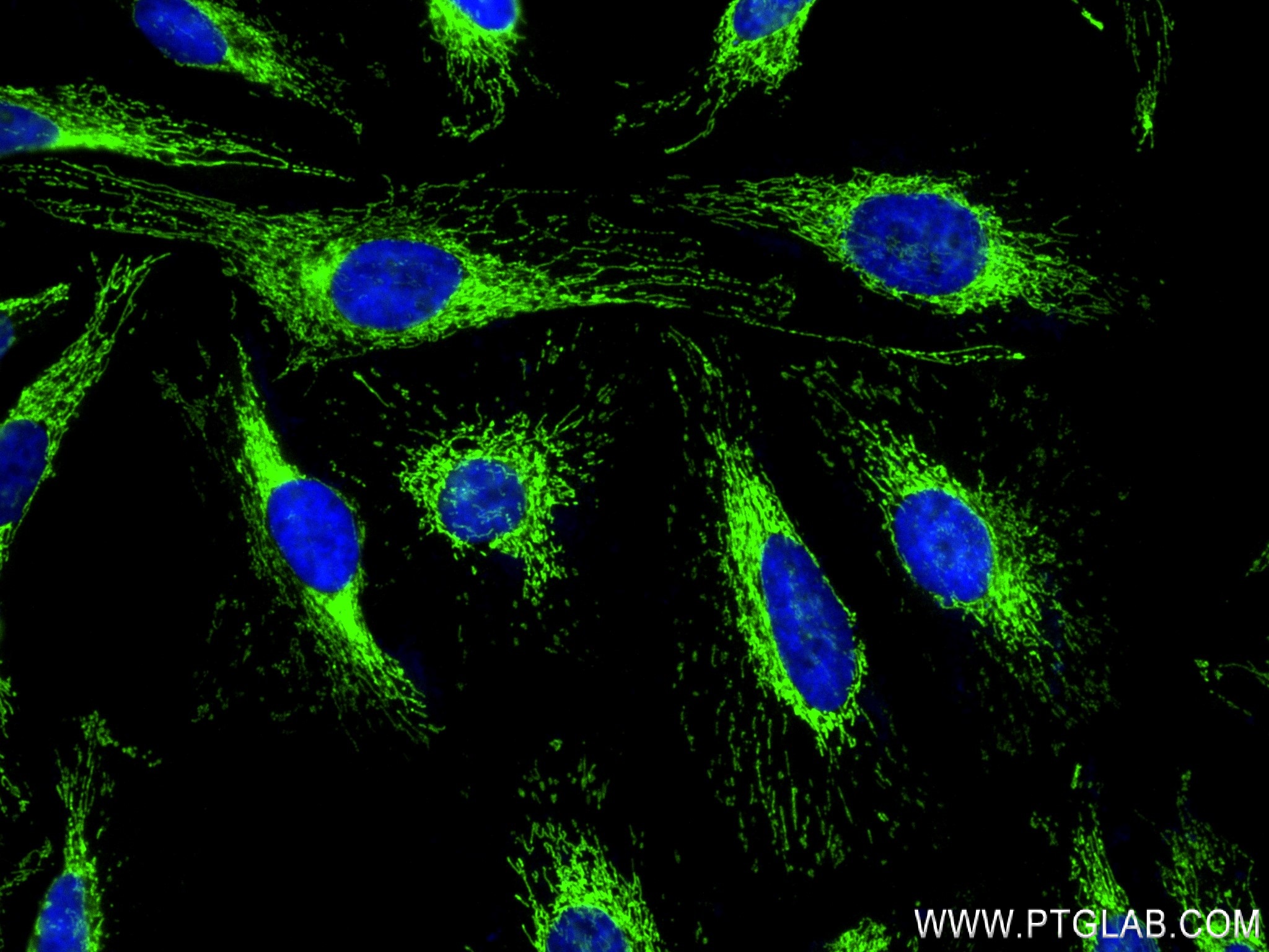 IF Staining of Hela using 84302-2-RR