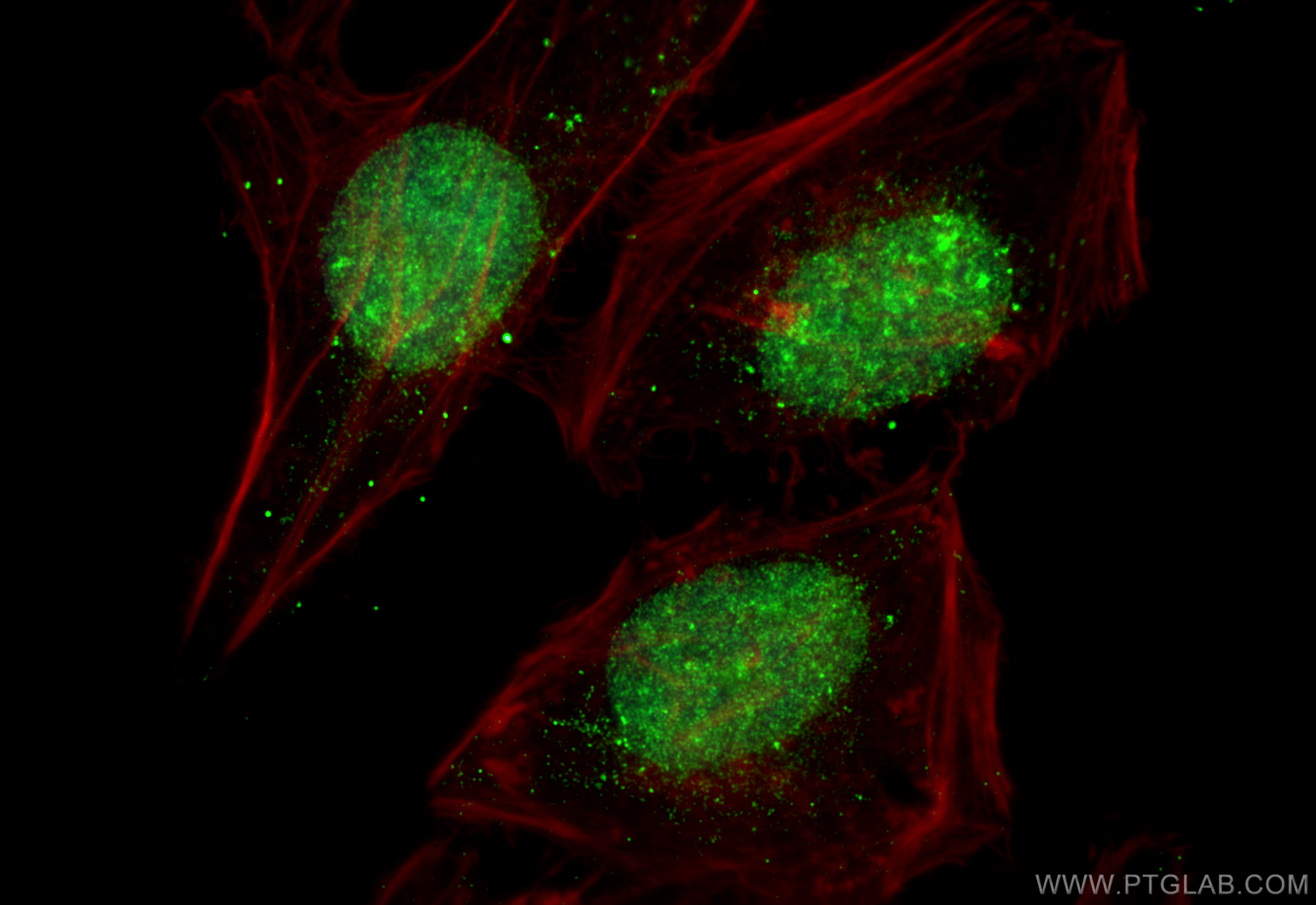 IF Staining of HeLa using 27917-1-AP