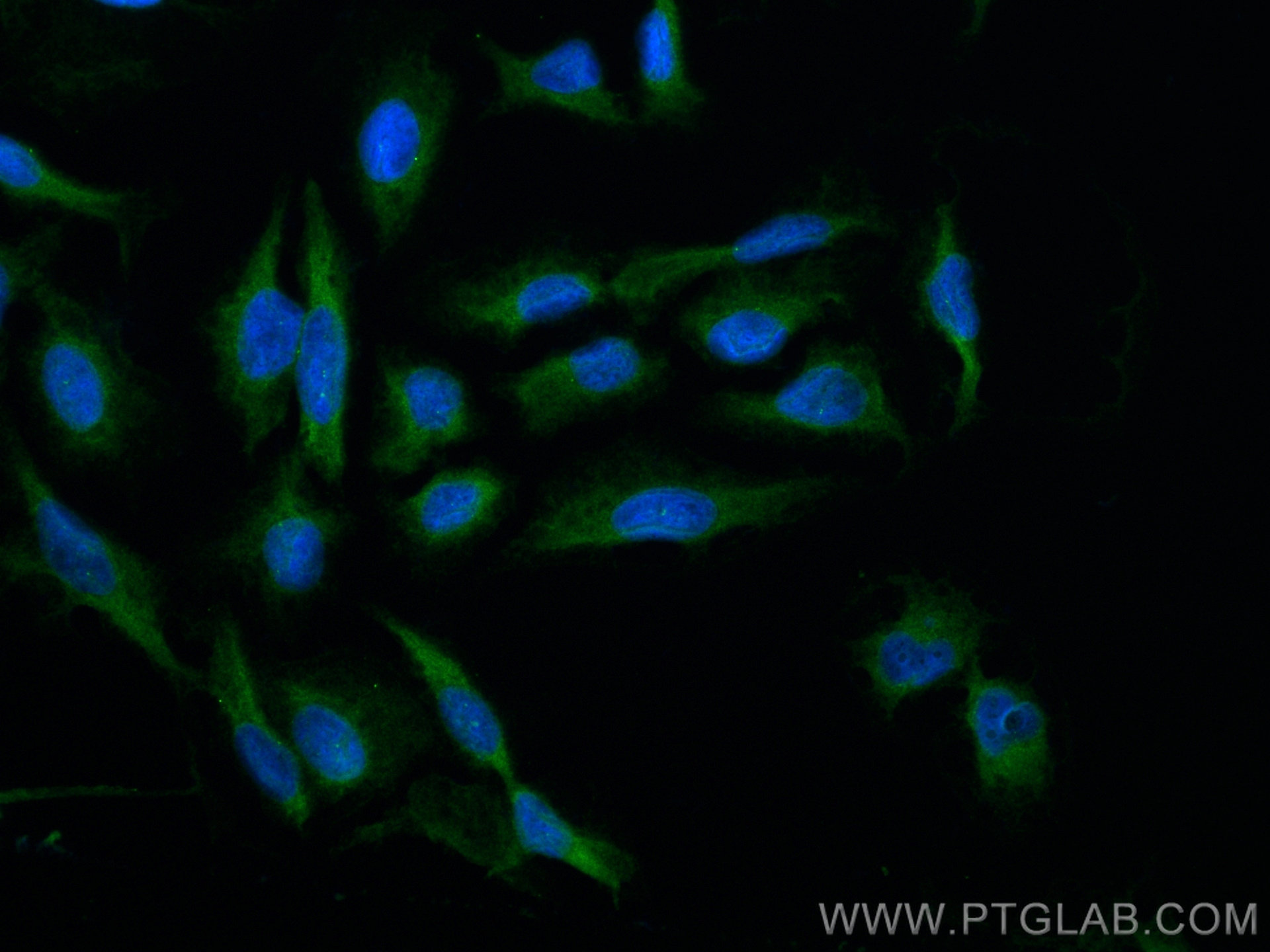 IF Staining of U2OS using 10317-1-AP