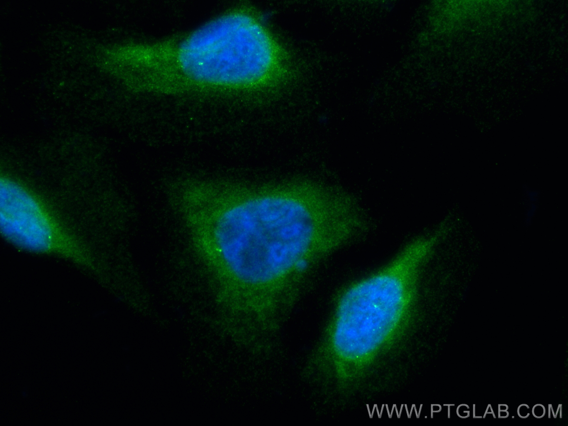 IF Staining of U2OS using 10317-1-AP