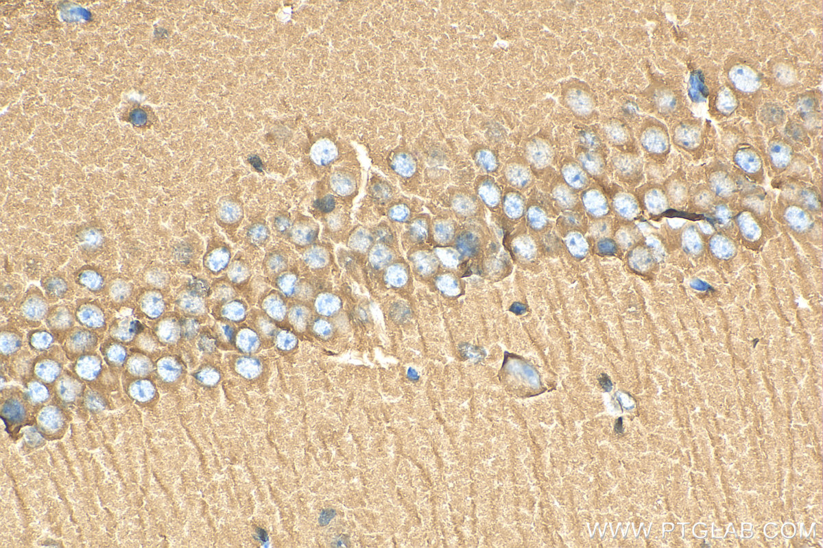 IHC staining of mouse brain using 10317-1-AP