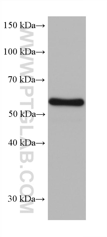 WB analysis of pig brain using 68272-1-Ig