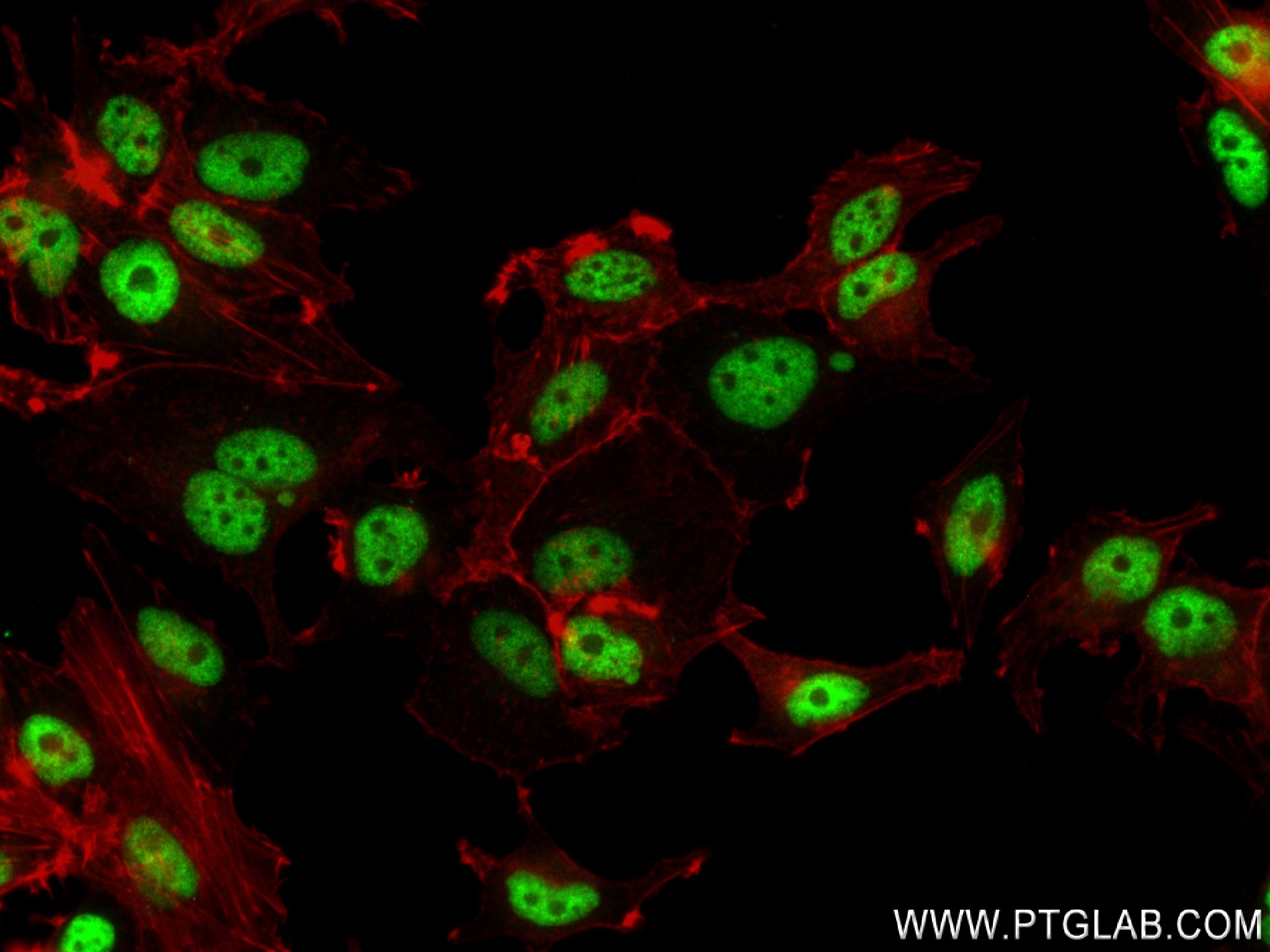 IF Staining of MCF-7 using 83914-1-RR