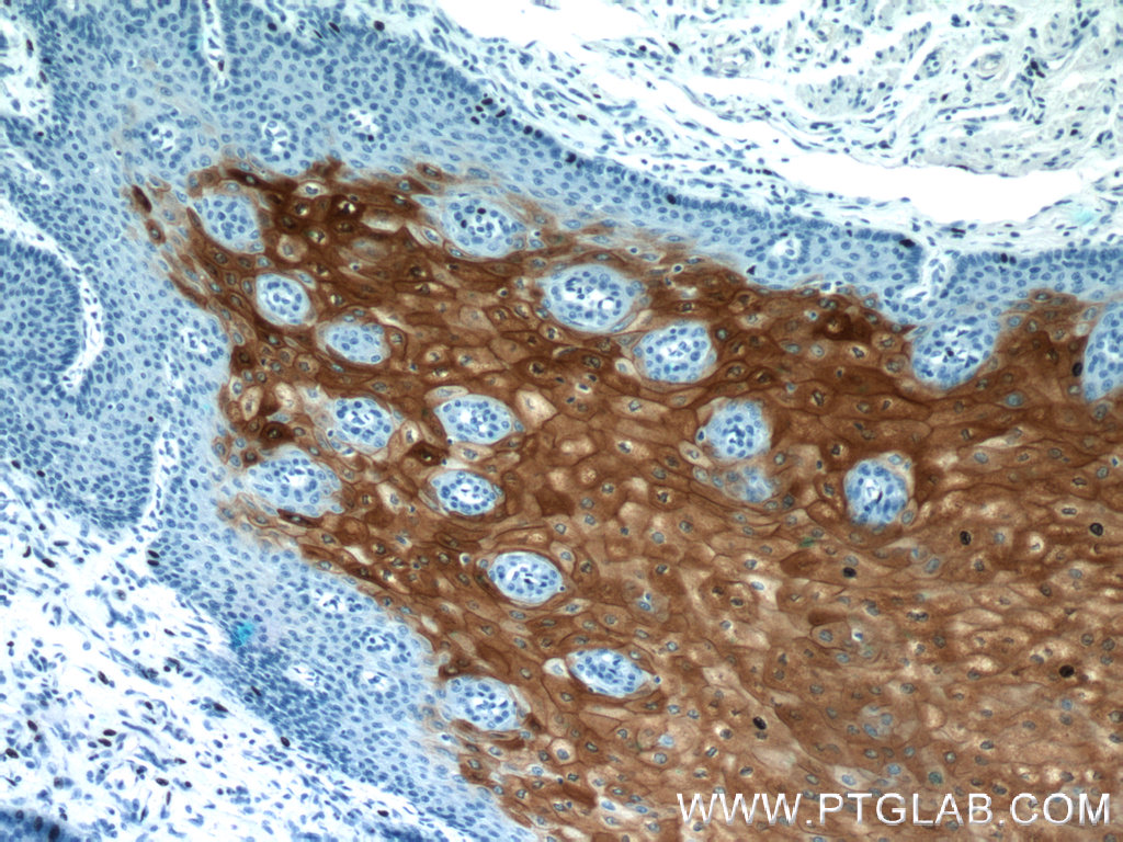 IHC staining of human oesophagus using 11799-1-AP