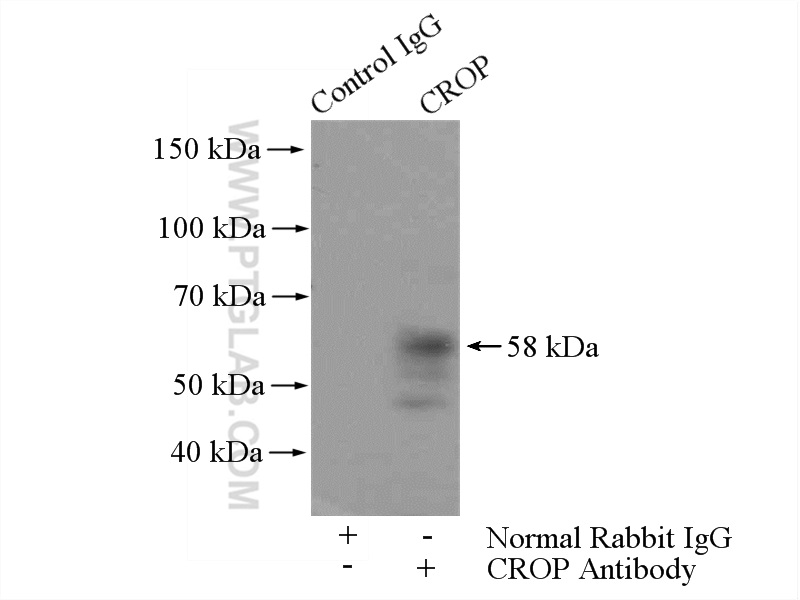 IP experiment of HepG2 using 14504-1-AP