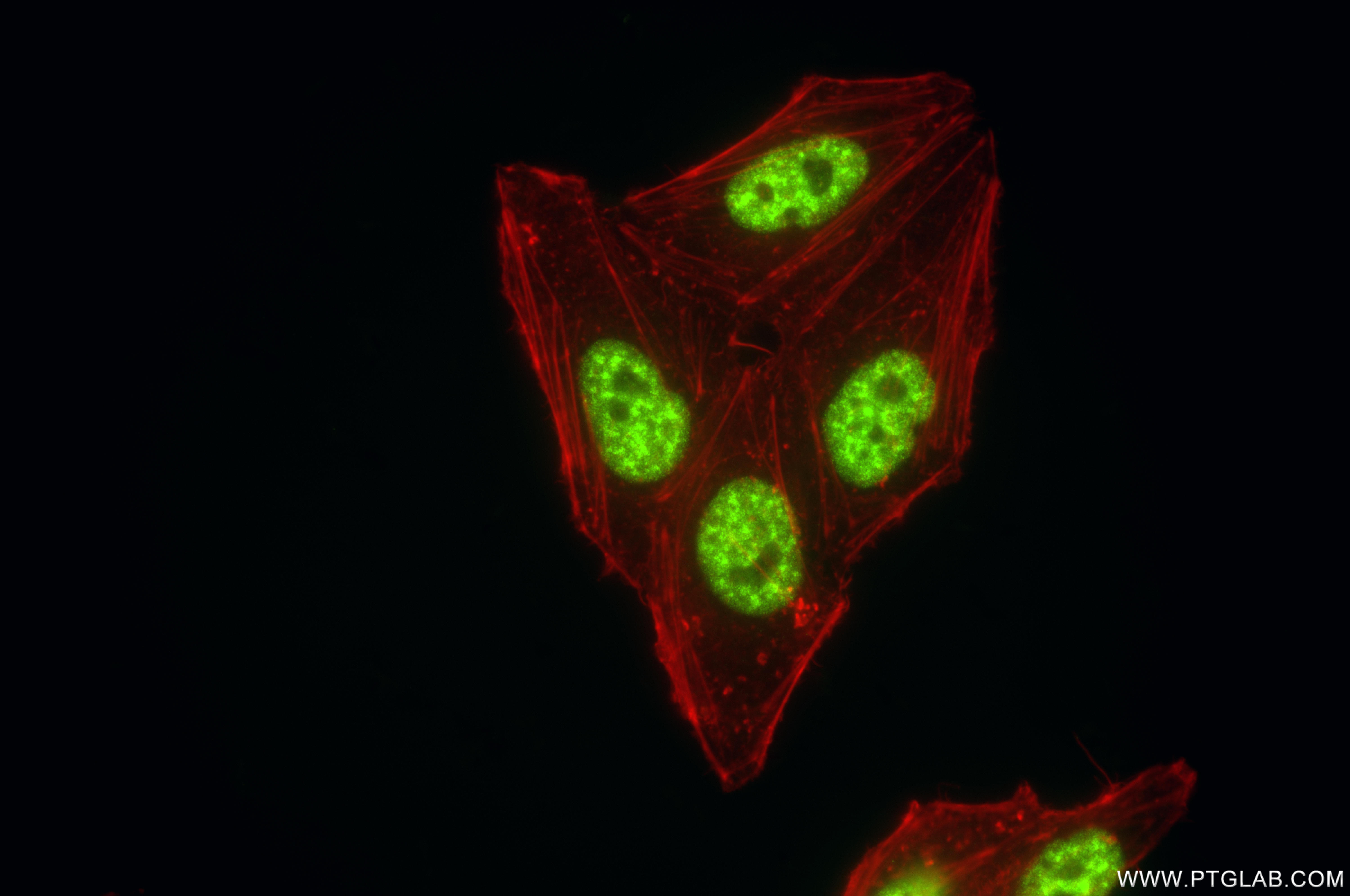 IF Staining of HepG2 using 86690-1-RR IF Staining of HepG2 using 86690-1-RR
