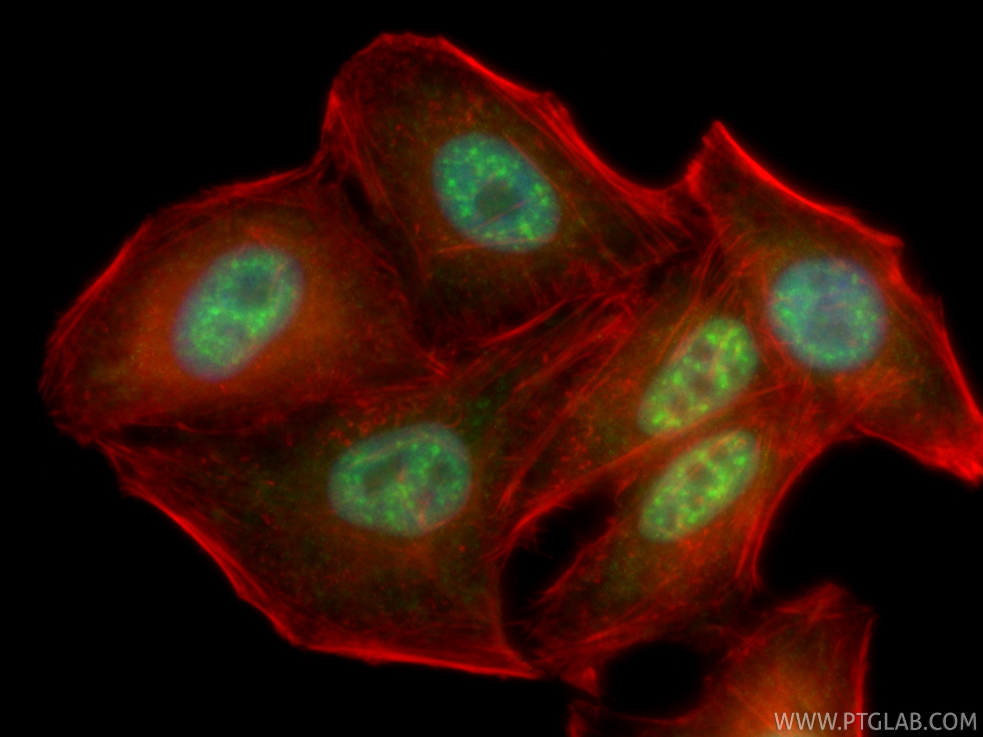 IF Staining of HepG2 using CL488-86690 IF Staining of HepG2 using CL488-86690