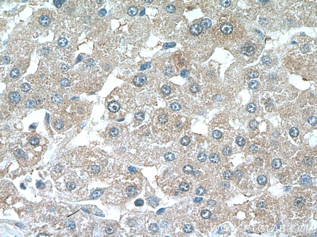 IHC staining of human liver using 24175-1-AP
