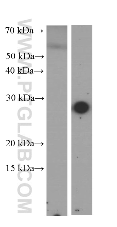 WB analysis of serum from mouse injected with bacteria using 66250-1-Ig