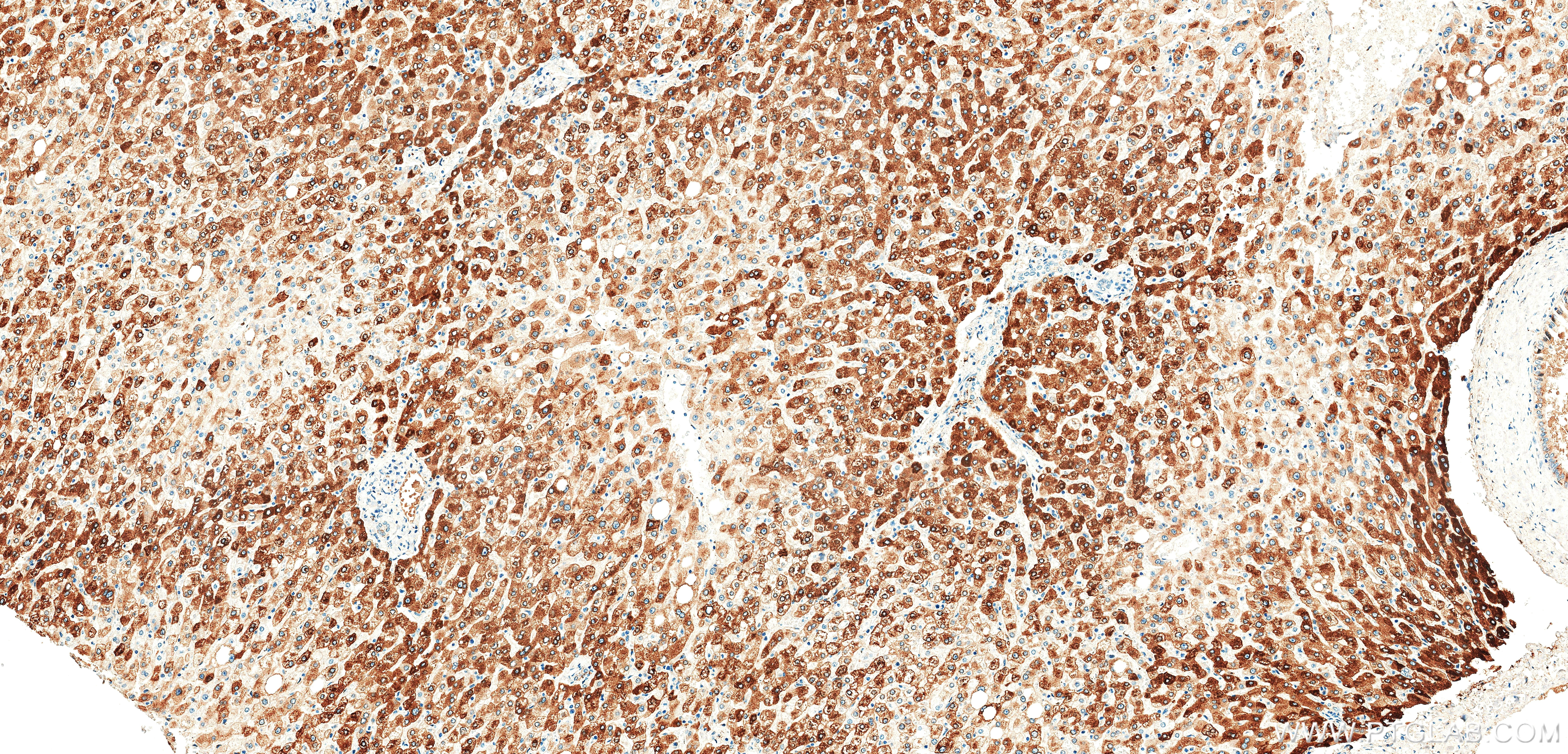 IHC staining of human liver using 86912-6-RR (same clone as 86912-6-PBS) IHC staining of human liver using 86912-6-RR (same clone as 86912-6-PBS)