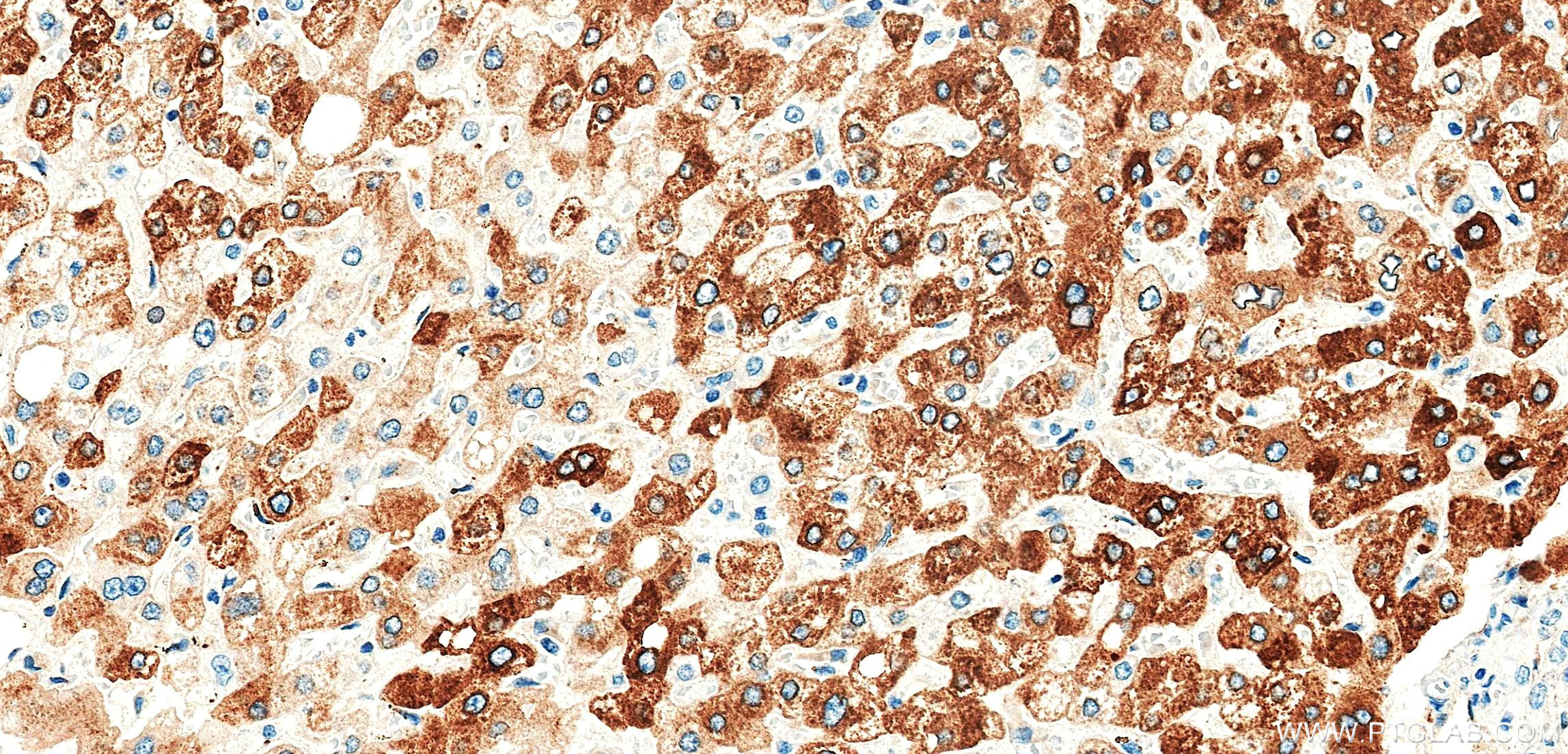 IHC staining of human liver using 86912-6-RR (same clone as 86912-6-PBS) IHC staining of human liver using 86912-6-RR (same clone as 86912-6-PBS)
