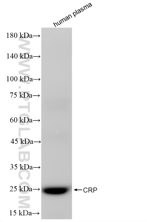 WB analysis using 86912-6-RR (same clone as 86912-6-PBS) WB analysis using 86912-6-RR (same clone as 86912-6-PBS)