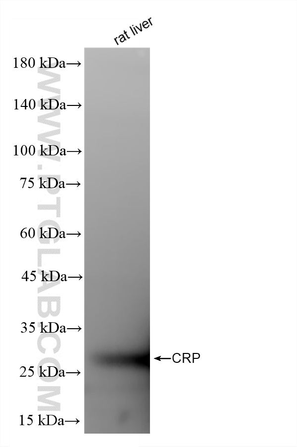 WB analysis using 86912-6-RR (same clone as 86912-6-PBS) WB analysis using 86912-6-RR (same clone as 86912-6-PBS)