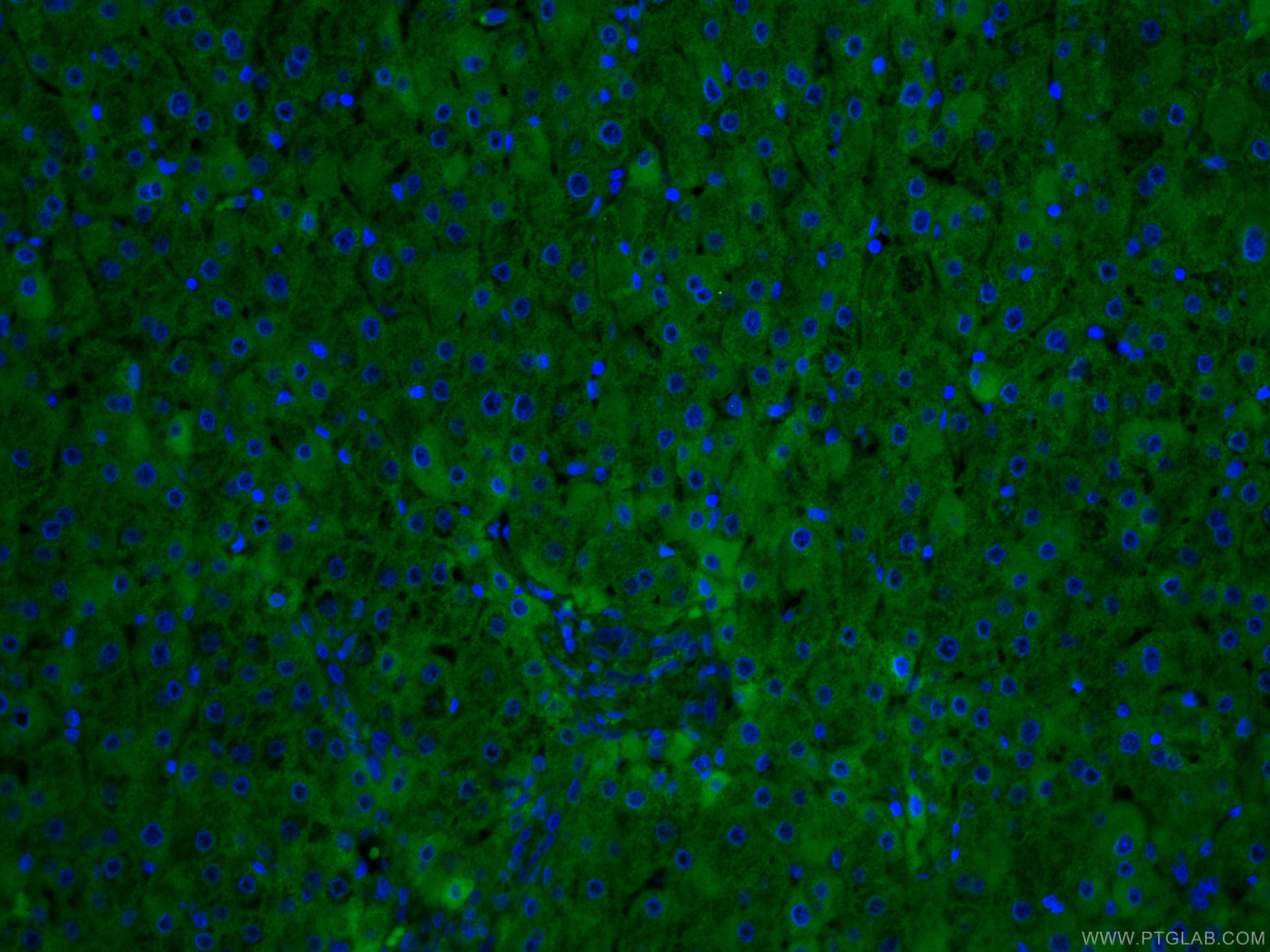 IF Staining of human liver using CL488-66250