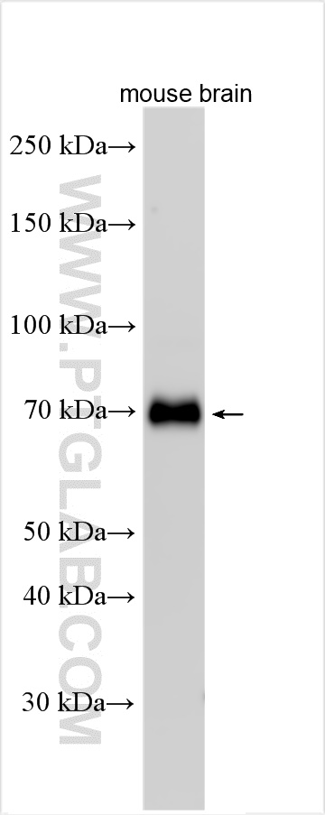 WB analysis using 30251-1-AP