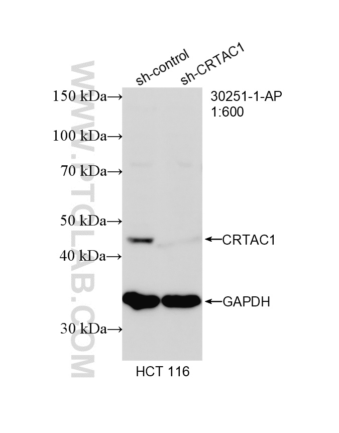 WB analysis of HCT 116 using 30251-1-AP (same clone as 30251-1-PBS) WB analysis of HCT 116 using 30251-1-AP (same clone as 30251-1-PBS)