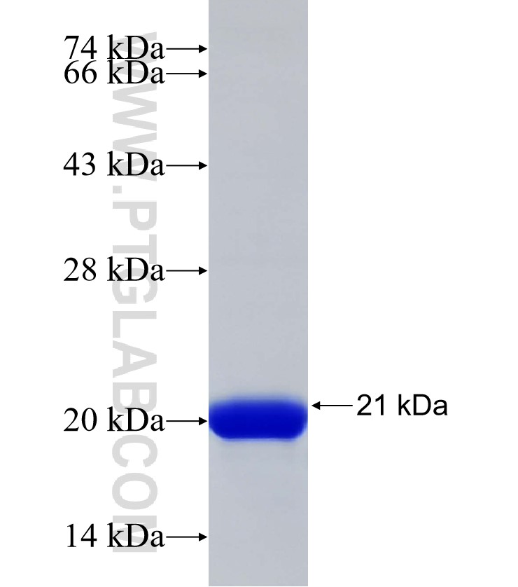CRTAC1 fusion protein Ag32943 SDS-PAGE CRTAC1 fusion protein Ag32943 SDS-PAGE