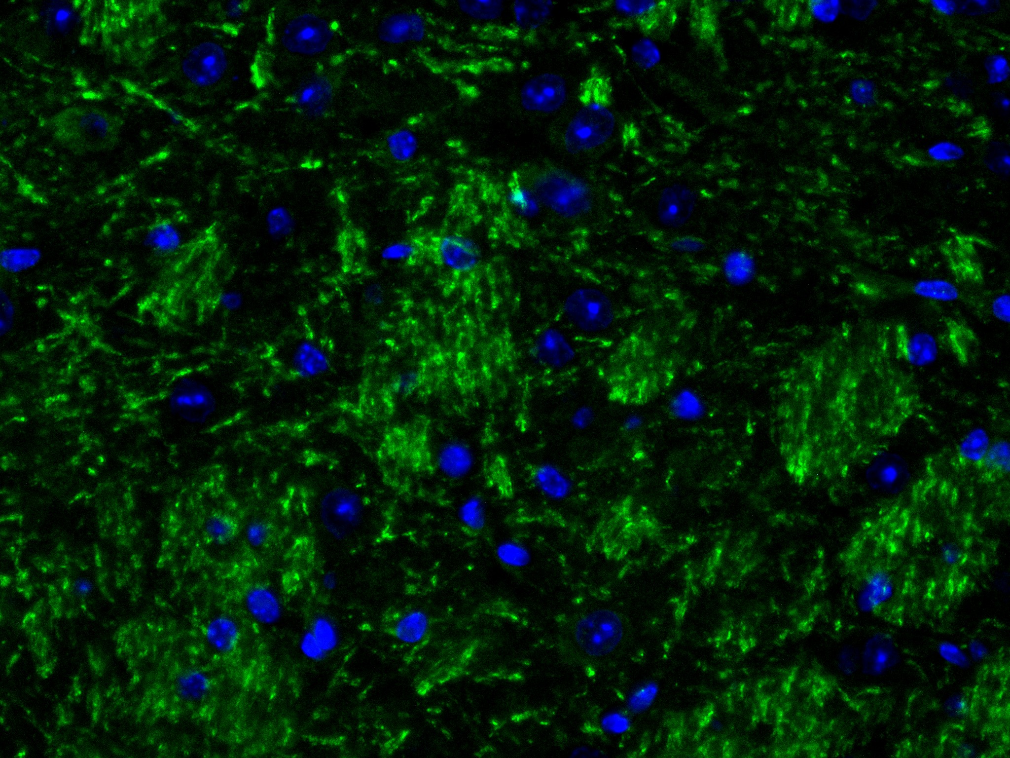 IF Staining of mouse brain using 84068-4-RR (same clone as 84068-4-PBS)