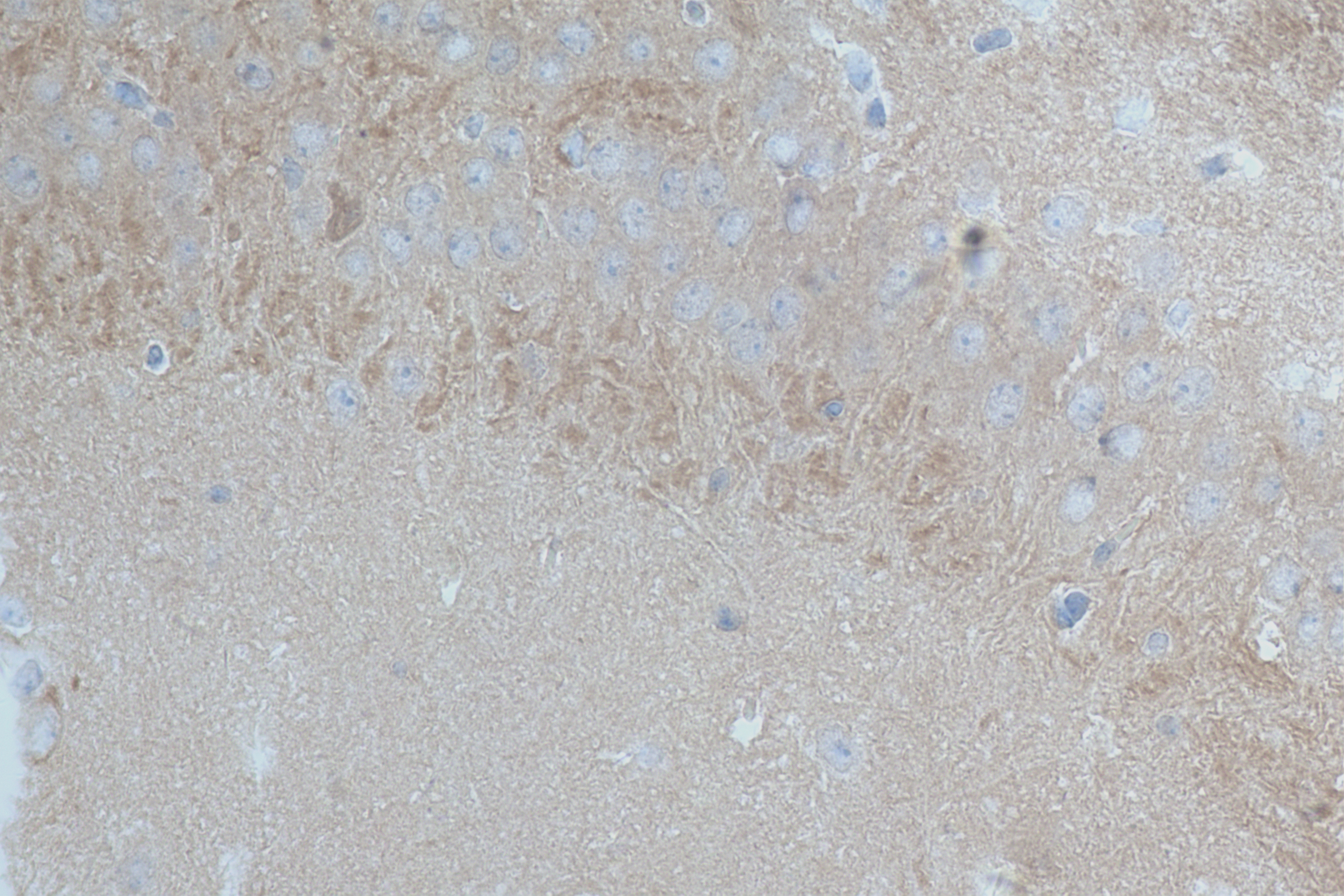 IHC staining of mouse brain using 84068-4-RR (same clone as 84068-4-PBS)