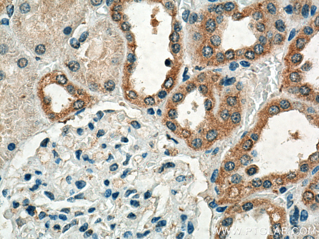 IHC staining of human kidney using 15724-1-AP