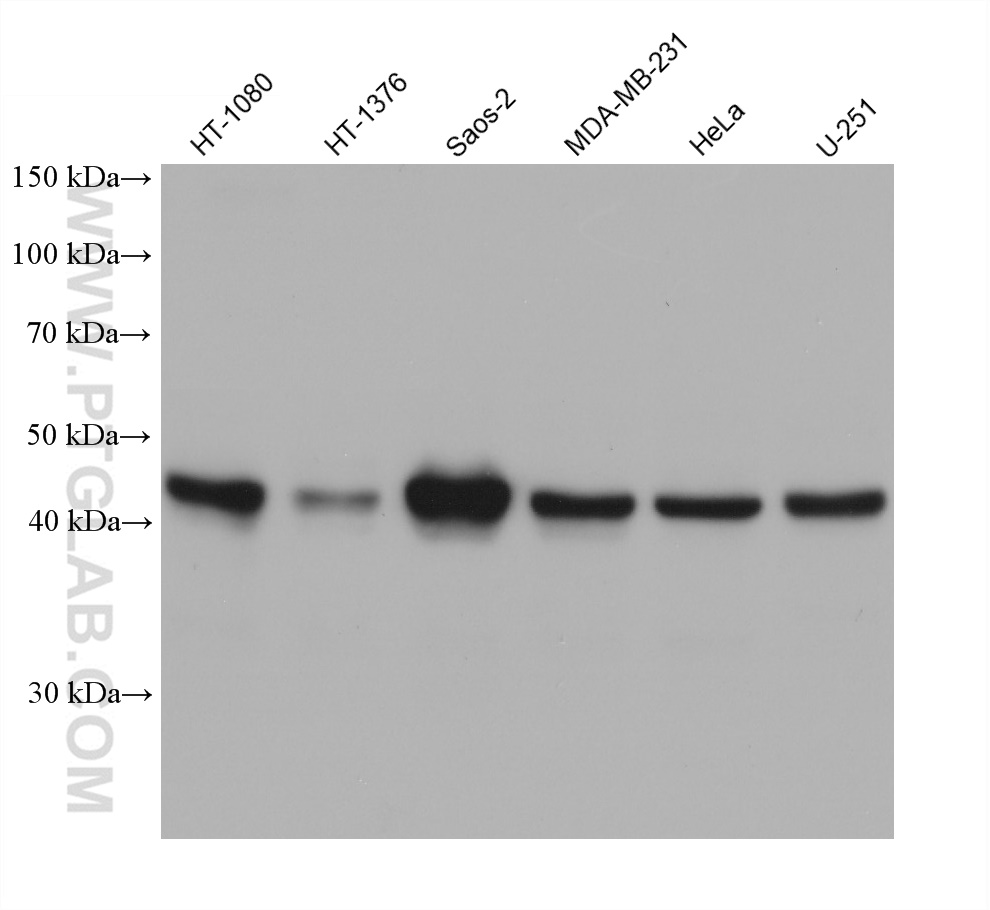WB analysis using 68458-1-Ig (same clone as 68458-1-PBS)
