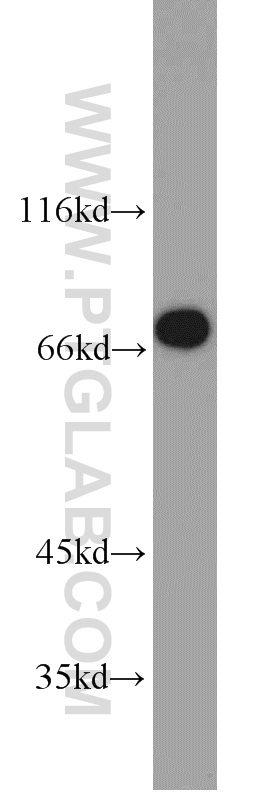 WB analysis of mouse kidney using 10441-1-AP