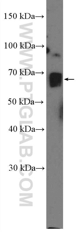 WB analysis of mouse brain using 25476-1-AP