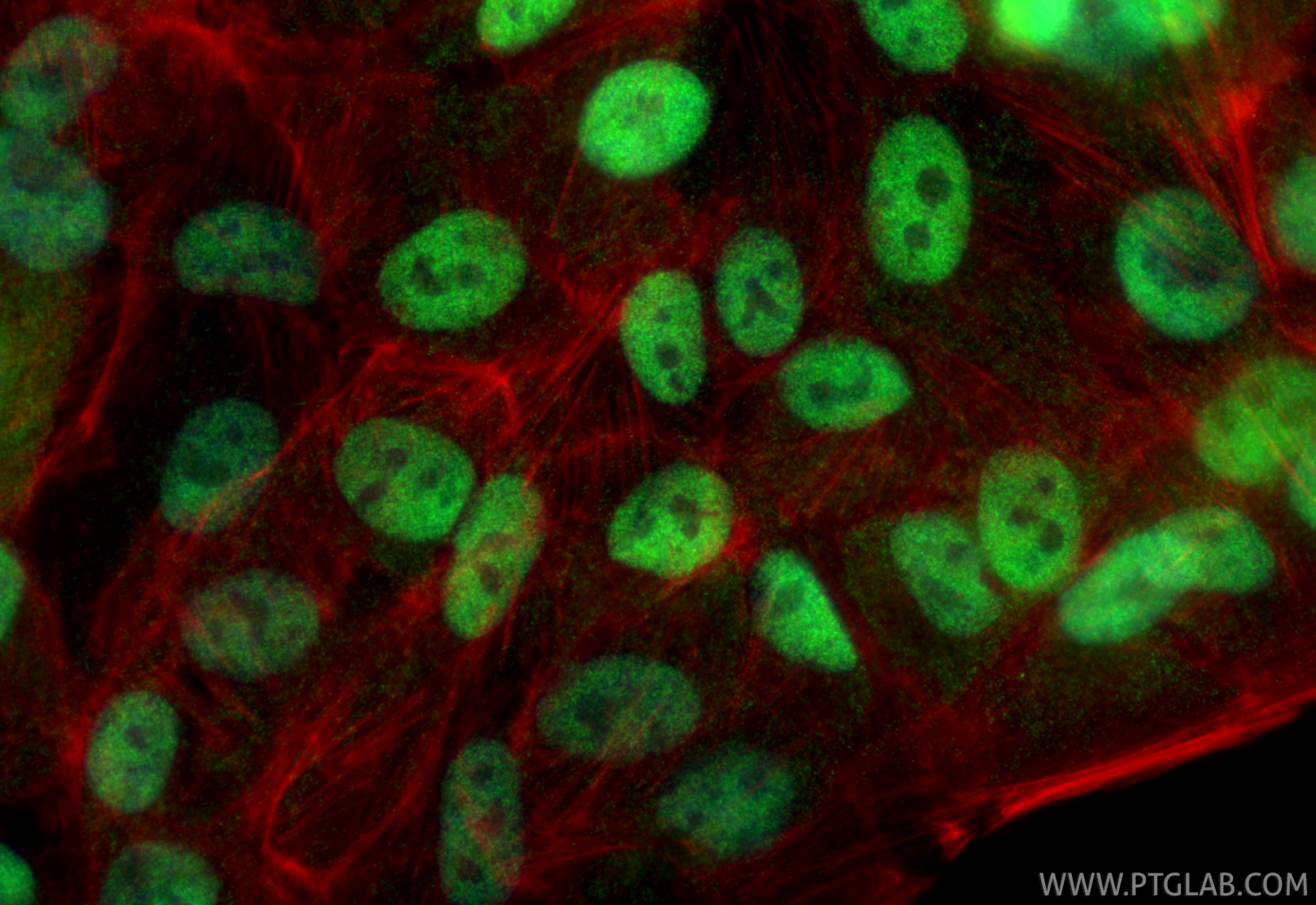 Immunofluorescent analysis of (4% PFA) fixed hTERT-RPE1 cells using CRX antibody (12047-1-AP) at dilution of 1:200 and CoraLite®488-Conjugated Goat Anti-Rabbit IgG(H+L) (<a class='green' href='/productredirect?CatalogNo=SA00013-2' target='_blank'>SA00013-2</a>), CL594-Phalloidin (red). IF Staining of hTERT-RPE1 using 12047-1-AP