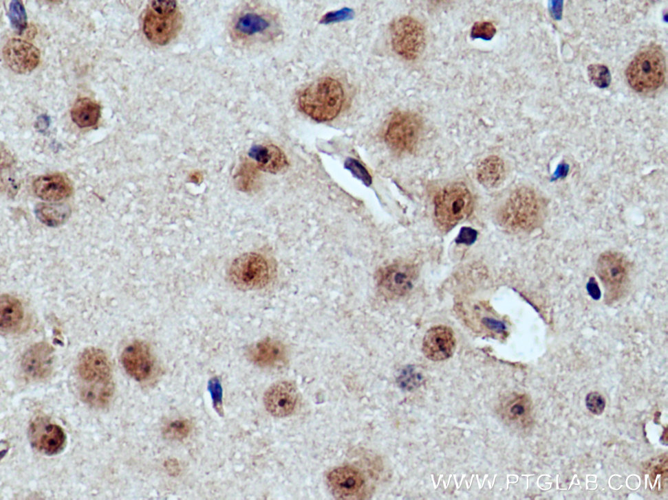 IHC staining of mouse brain using 13997-1-AP