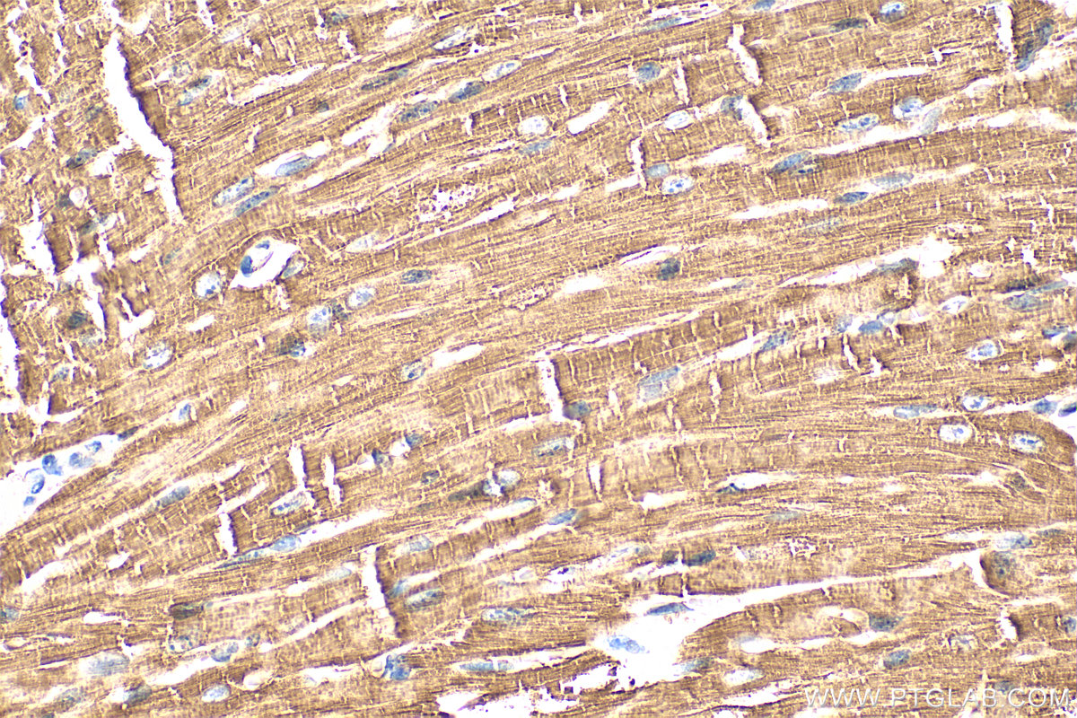 IHC staining of mouse heart using 15808-1-AP