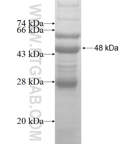 CRYBA2 fusion protein Ag8222 SDS-PAGE