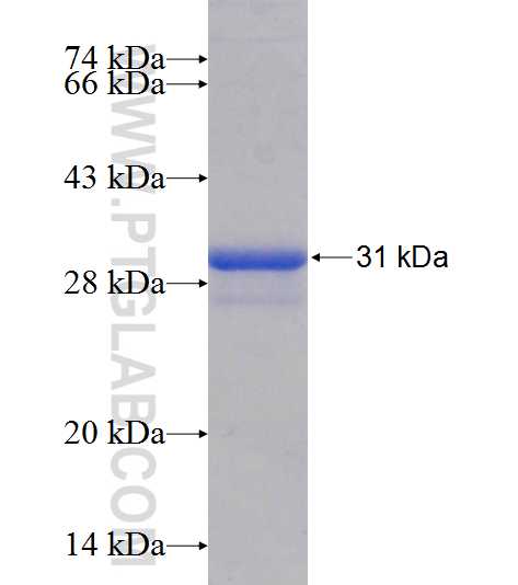 CRYBA4 fusion protein Ag24971 SDS-PAGE