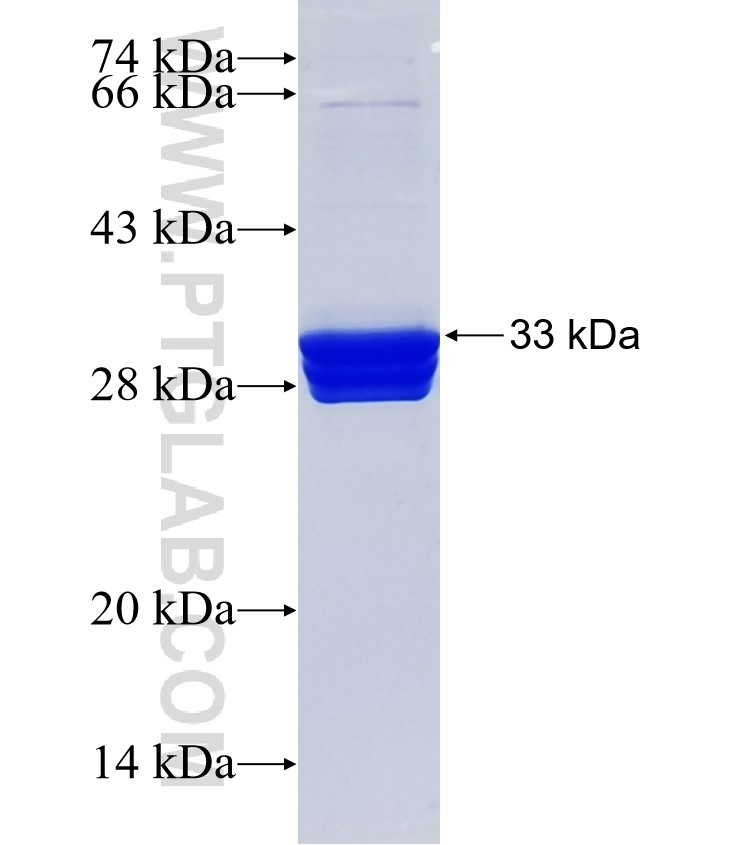 CRYBA4 fusion protein Ag24971 SDS-PAGE