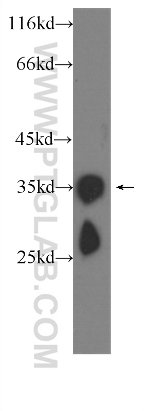 WB analysis of C6 using 60273-1-Ig