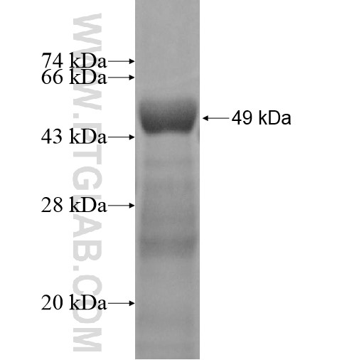 CRYBB2 fusion protein Ag12906 SDS-PAGE