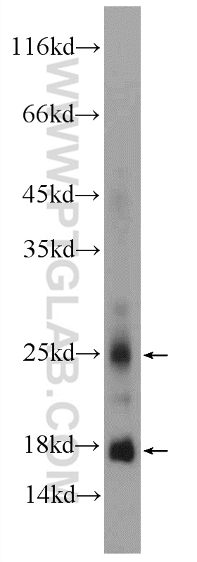 WB analysis of mouse eye using 21281-1-AP