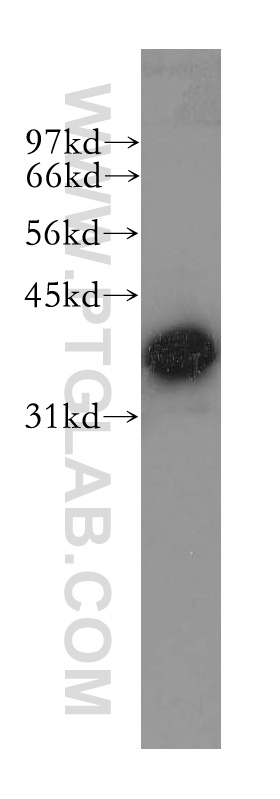 Mu Crystallin Polyclonal antibody