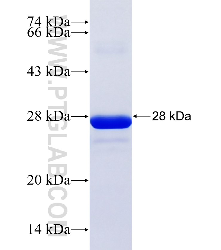 CRYZ fusion protein Ag35459 SDS-PAGE CRYZ fusion protein Ag35459 SDS-PAGE
