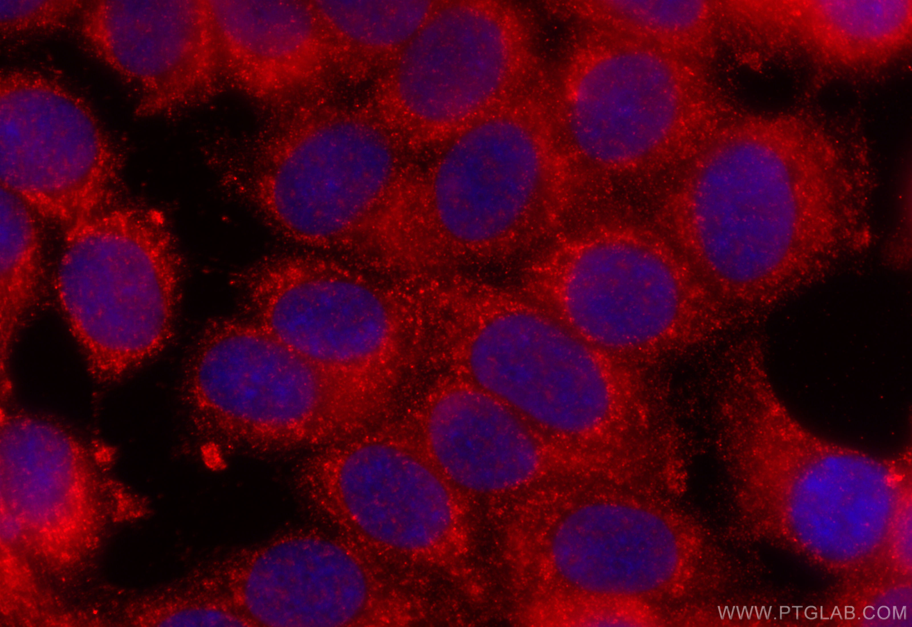 IF Staining of MCF-7 using 22870-1-AP