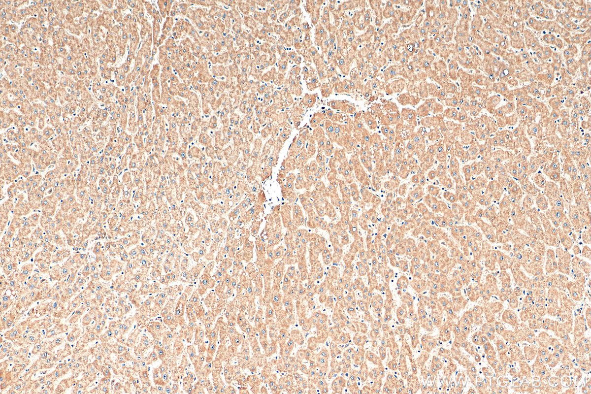 IHC staining of human liver using 22870-1-AP