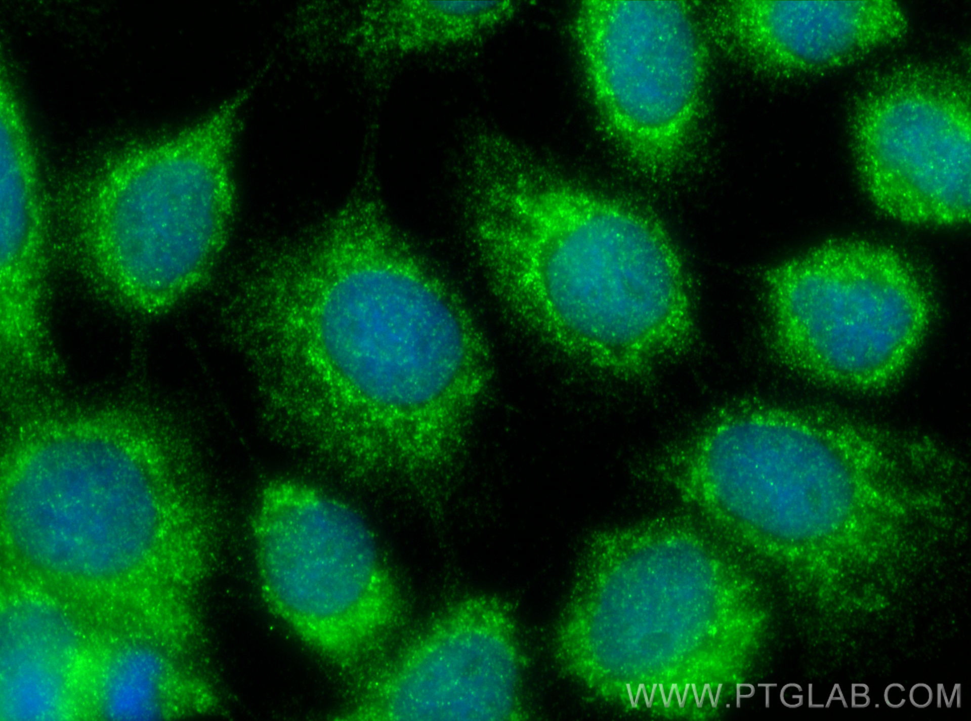 IF Staining of A431 using 27785-1-AP