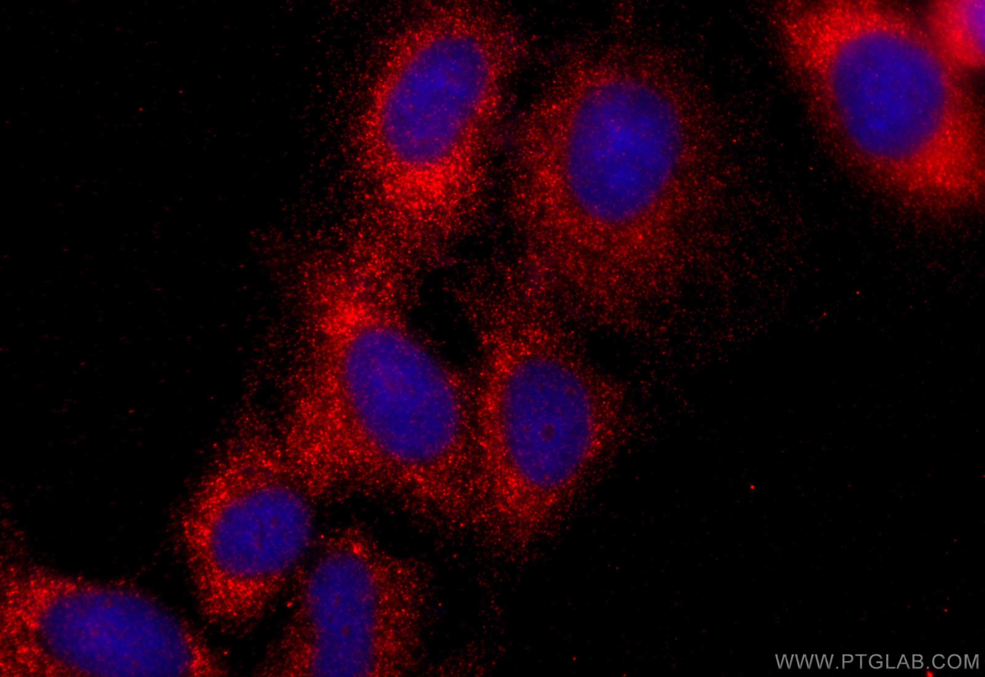 IF Staining of U2OS using 31704-1-AP