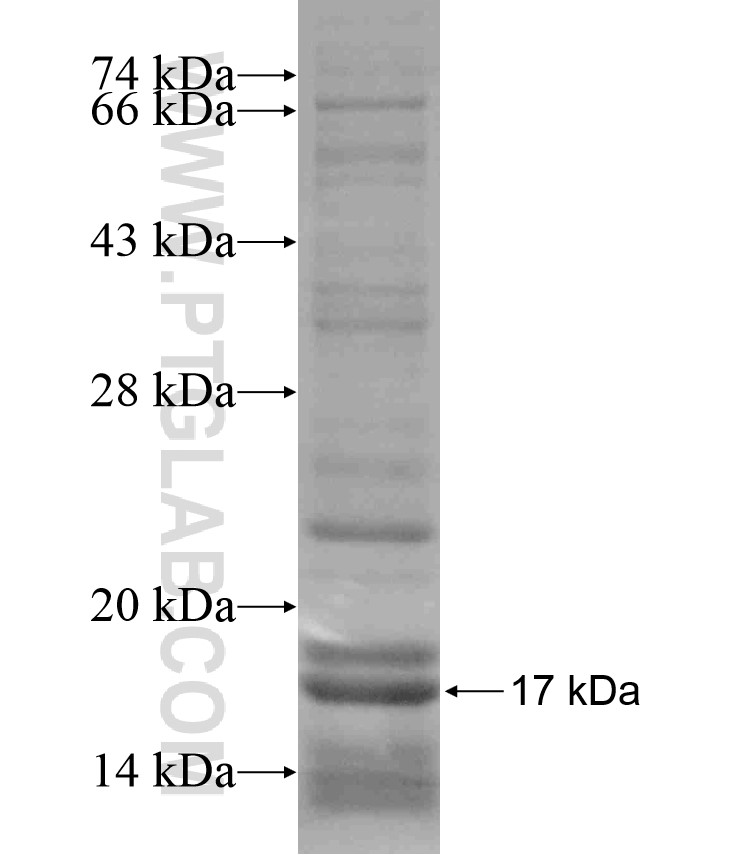 CSDC2 fusion protein Ag17012 SDS-PAGE CSDC2 fusion protein Ag17012 SDS-PAGE