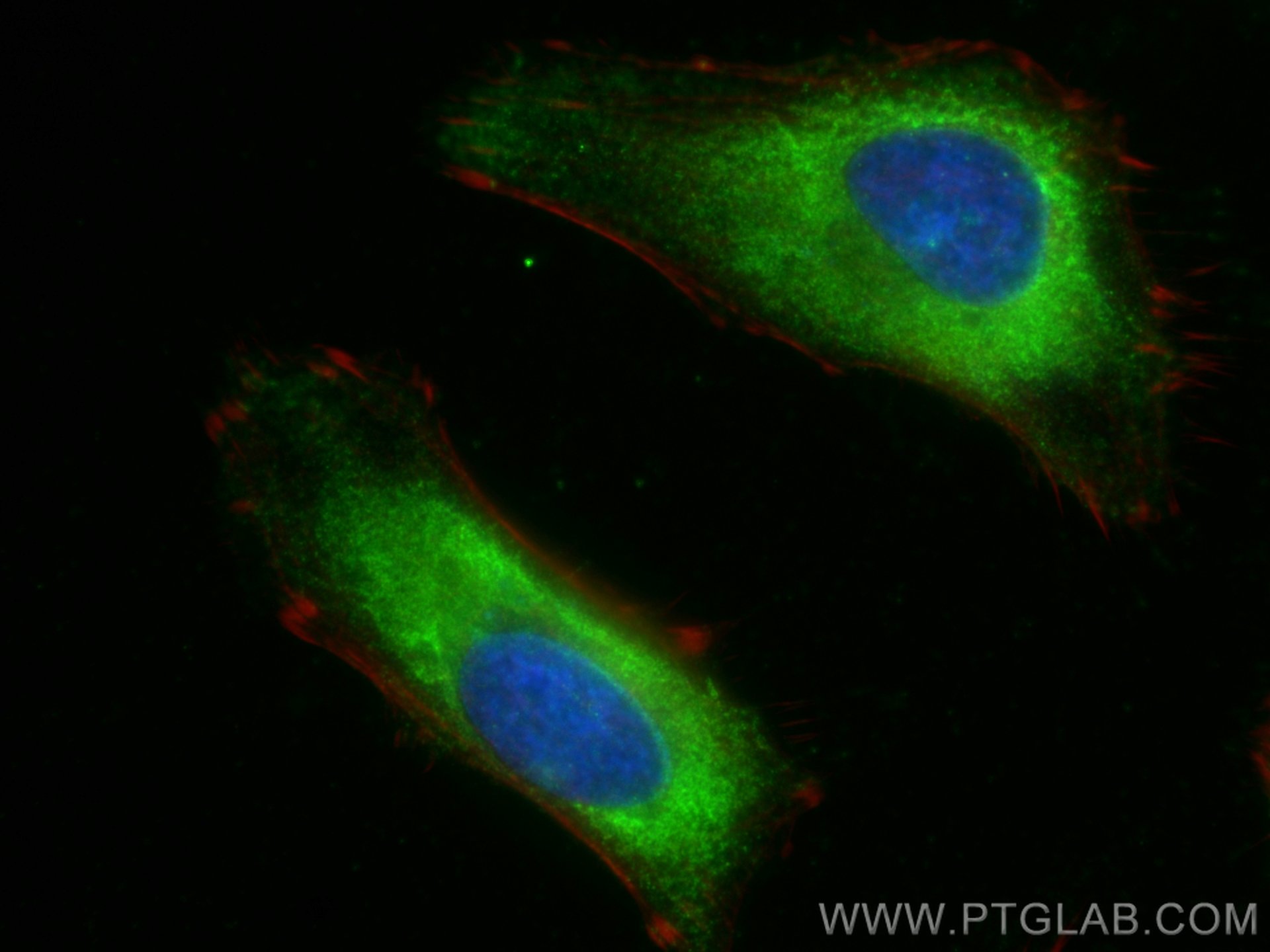 IF Staining of HeLa using 13319-1-AP