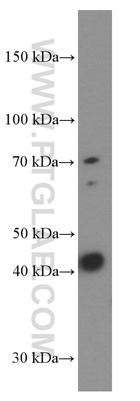 Gamma Cystathionase Monoclonal antibody