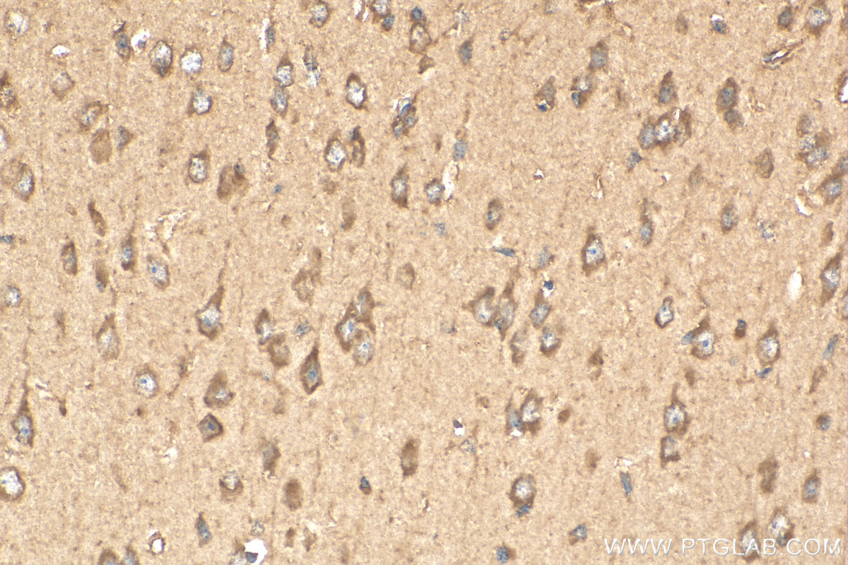 IHC staining of mouse brain using 25949-1-AP