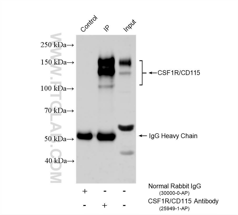 IP experiment of THP-1 using 25949-1-AP IP experiment of THP-1 using 25949-1-AP