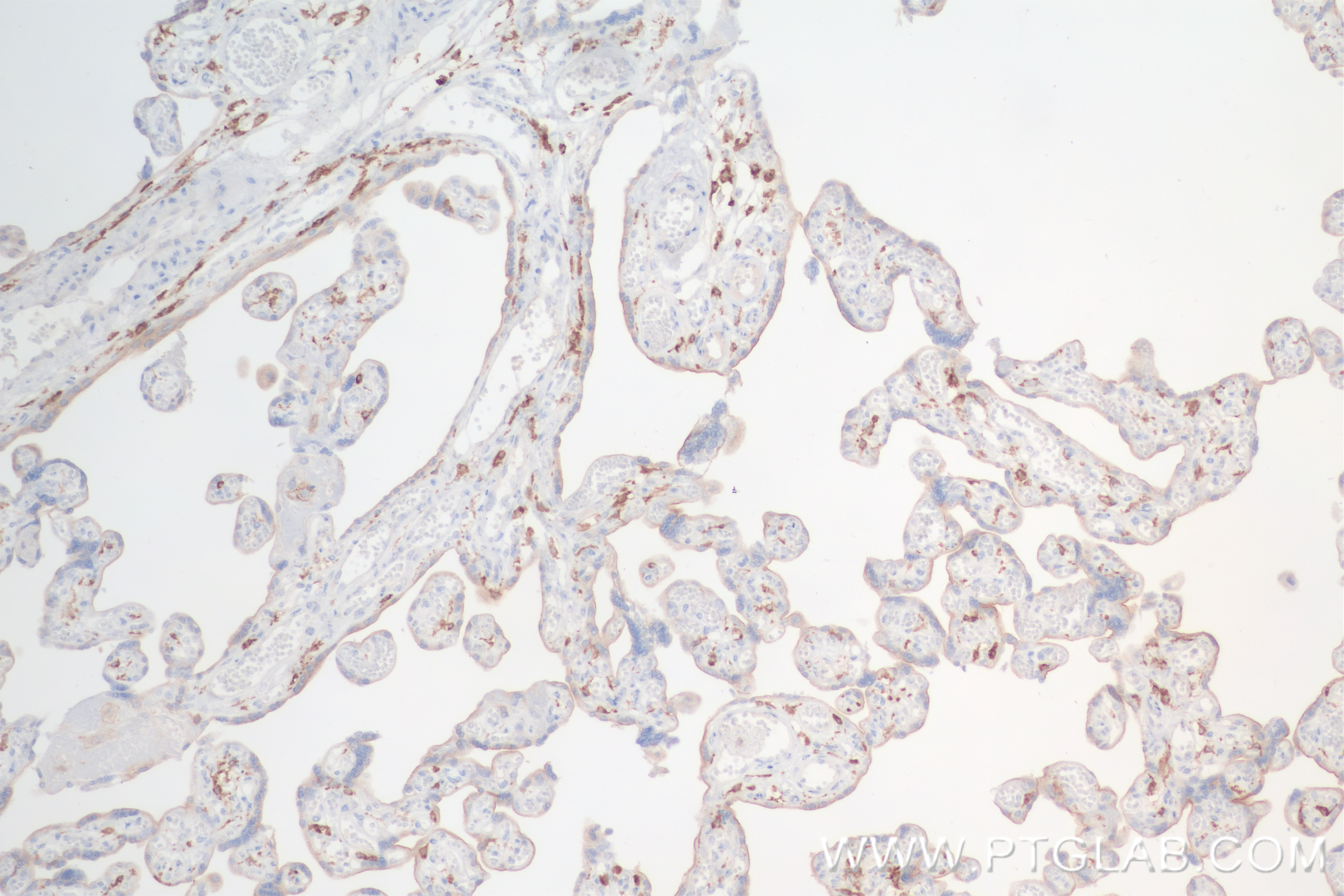 IHC staining of human placenta using 84477-6-RR