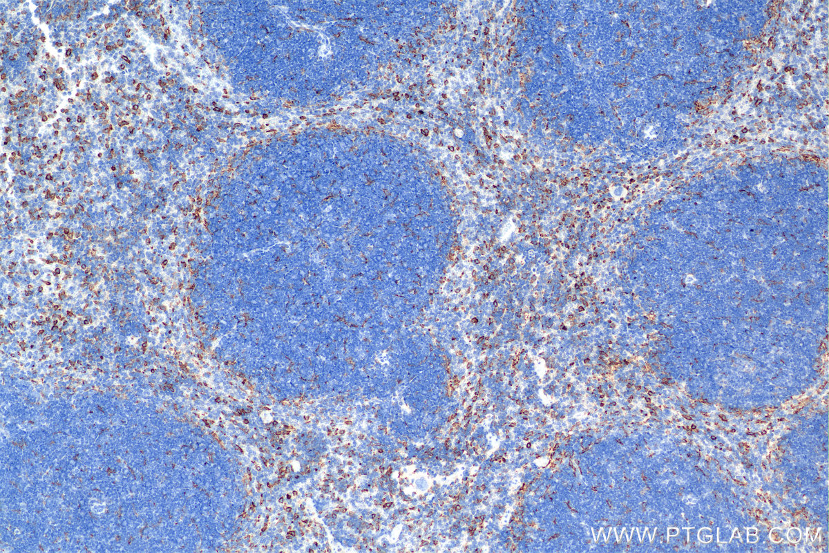 IHC staining of mouse spleen using 84919-6-RR