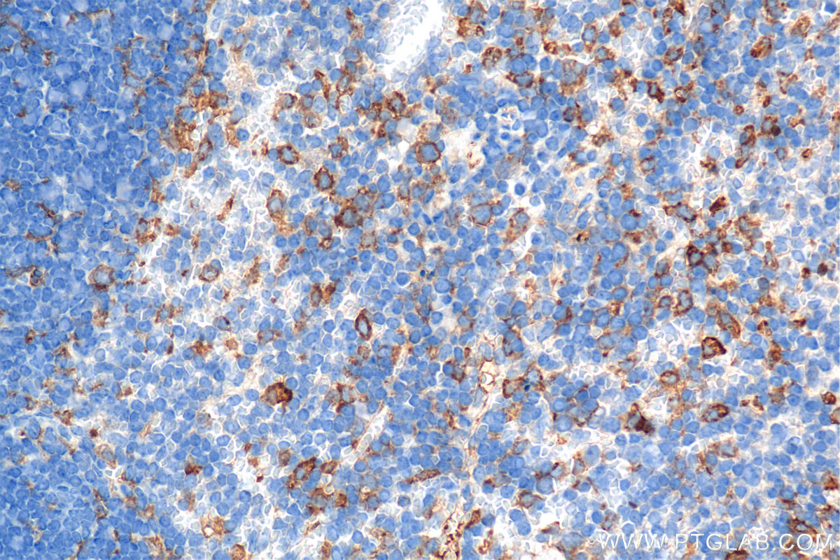 IHC staining of mouse spleen using 84919-6-RR
